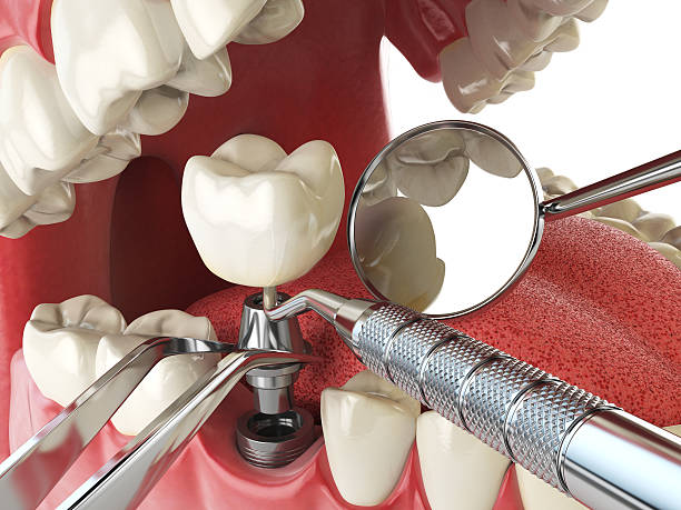 Best Emergency Dental Clinic in ND