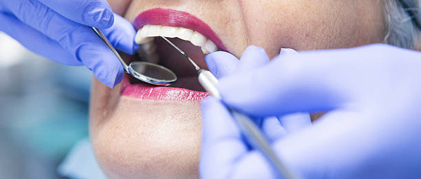 Best Teeth Whitening  in Washburn, ND